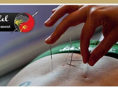 Acupuncture Gladstone & CQ - by Robyn Verdel