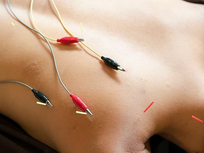 CC Body Mechanics - Acupuncture, Chinese Herbs & Massage